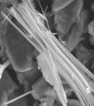 Magnified Asbestos Fibers